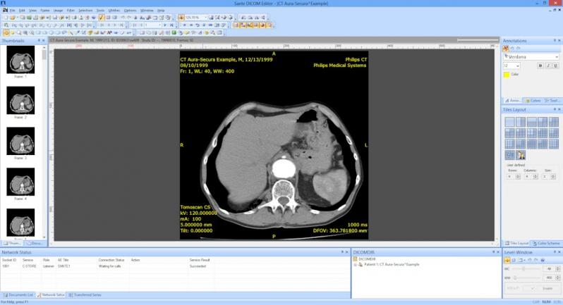 Sante DICOM Editor screenshot