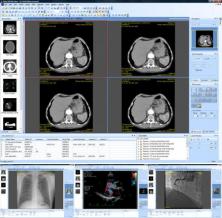 Sante DICOM Viewer Pro Screenshot